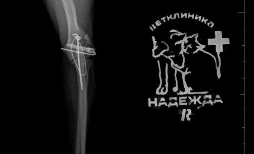 Снимки после операции остеосинтез