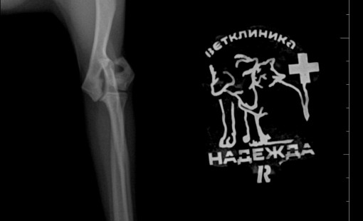 Снимок перелома плечевой кости до операции