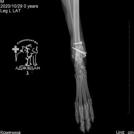 после операции