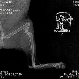 до операции