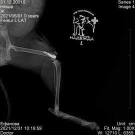 после операции