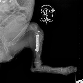 после операции