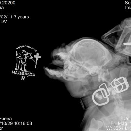 до операции