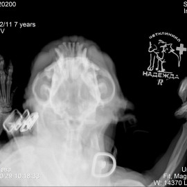 до операции