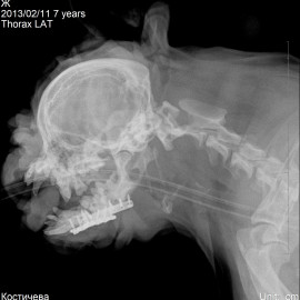 после операции