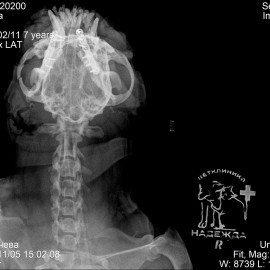 после операции