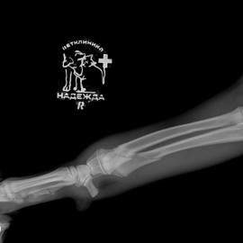 до операции