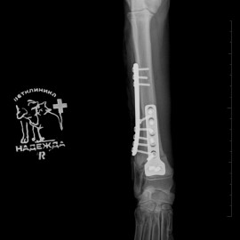 после операции